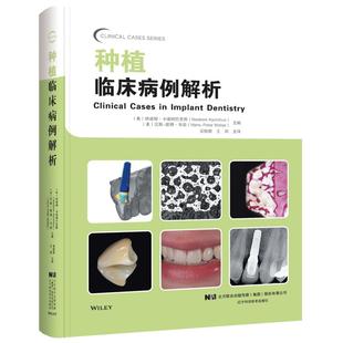 外科操作 种植临床病例解析 种植修复和后期维护书籍 种植外科与修复专业图书 纳迪姆·卡瑞姆巴克斯 病情诊断 种植体设计 美