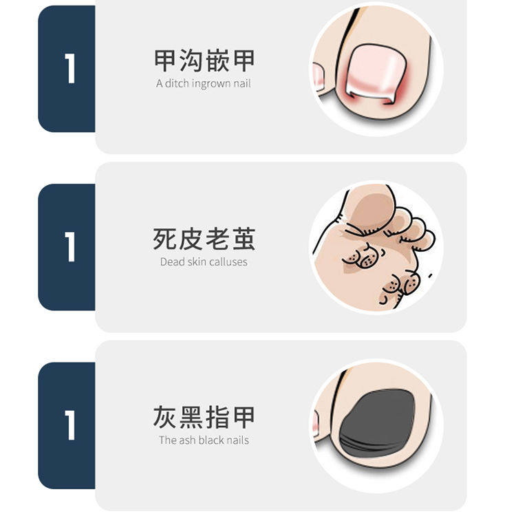 修脚刀家用去死皮老茧工具专业技师用刀具磨脚后跟刮脚皮刀套装