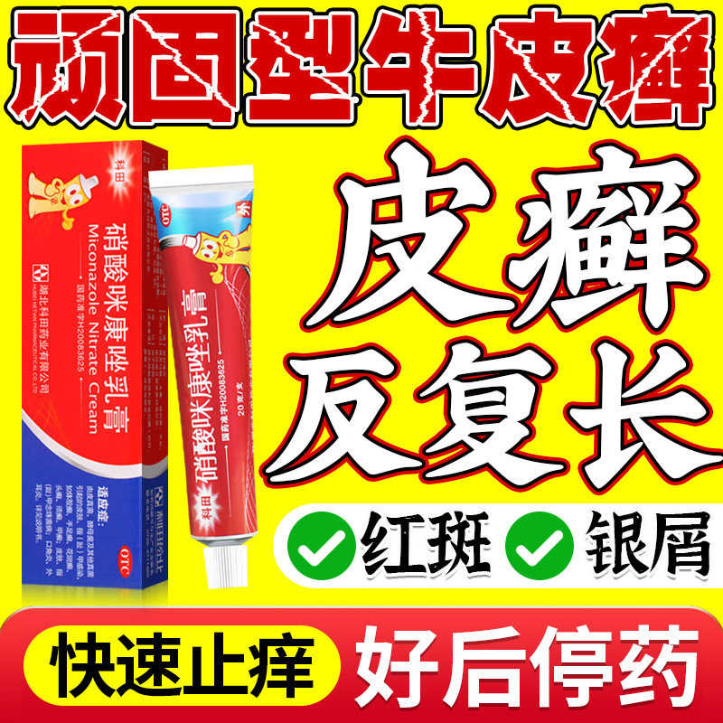 治疗顽固牛皮癣银屑病专用药膏皮肤癣痒真菌感染官方旗舰店特效NN