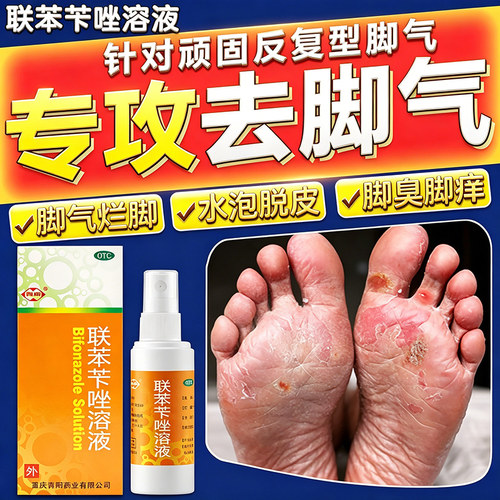 [西南]联苯苄唑溶液1%*50ml*1瓶/盒强效治脚气喷雾水泡型脚痒脚臭脱皮糜烂