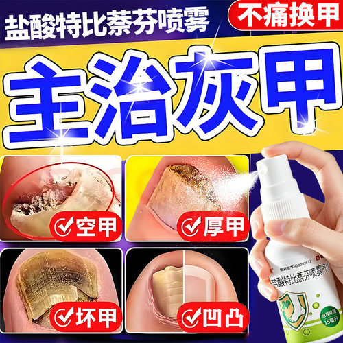 [伊人]盐酸特比萘芬喷雾剂1%*15ml*1瓶/盒