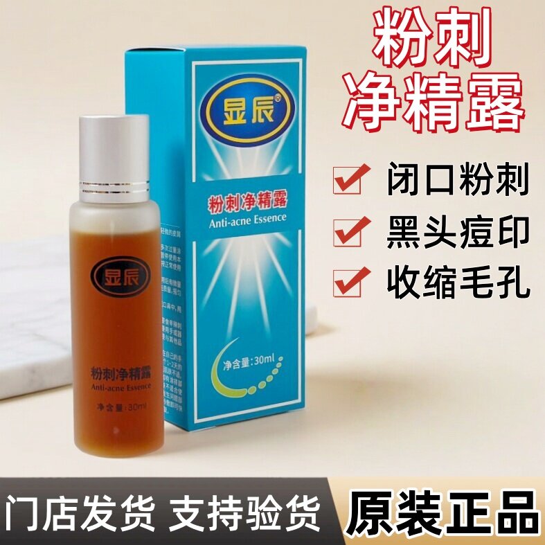 显辰泽平粉刺净精露草本萃取温和油痘肌痘印痘坑闭口粉刺黑头痤疮