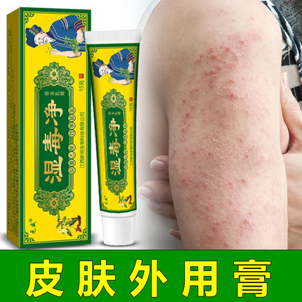 湿毒净皮肤快速止干痒膏男女大腿内侧抓挠手足头湿痒全身痒乳膏