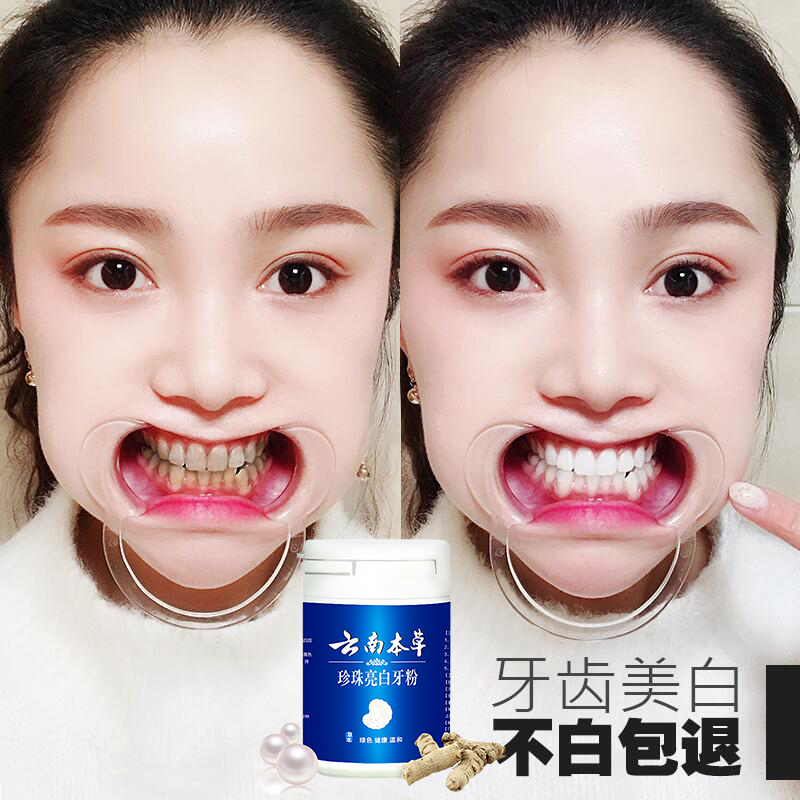 蘇打潔牙洗牙粉牙齒美白神器速效去黃牙漬煙漬除口臭牙結石牙斑凈