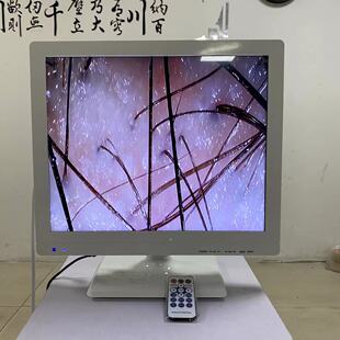 17寸带美容仪存储对比格头皮检测仪测试养发毛囊毛发分析头皮分析