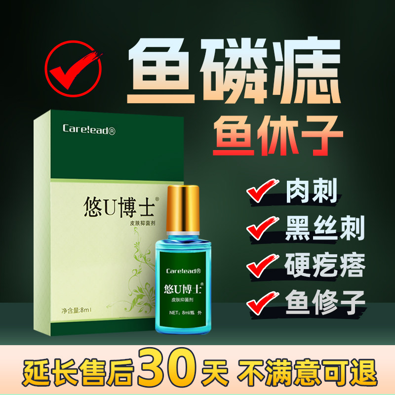 悠U博士去鱼鳞痣手脚上长鱼休子羞修子血胞刺非去除药水专用膏贴