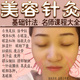 美容针灸视频课程中医针法教学针雕针刀面雕川字纹面部美容教程
