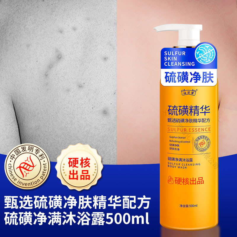 硫磺烟酰胺净满沐浴露皂液批发正品去鸡皮肤后背痘持久留香厂家