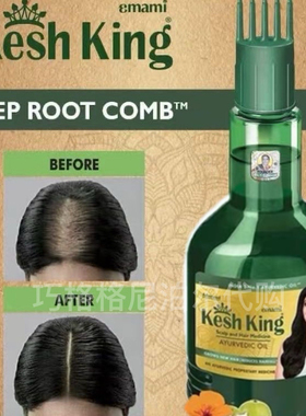 印度原装正品kesh king阿育吠陀21味草本植物养发护发护发素发油