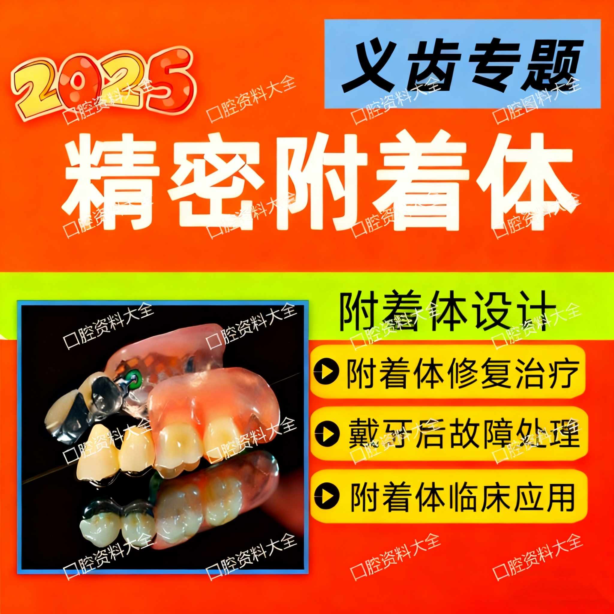 25年新全口义齿精密附着体视频课程局部活动义齿附着体设计