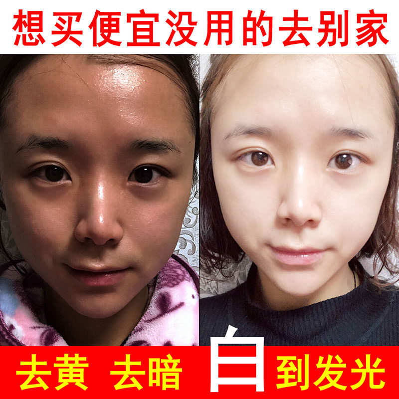 改善皮肤暗沉发黄护肤品变白黄皮肤美白脸部水提亮肤色去黄精华液