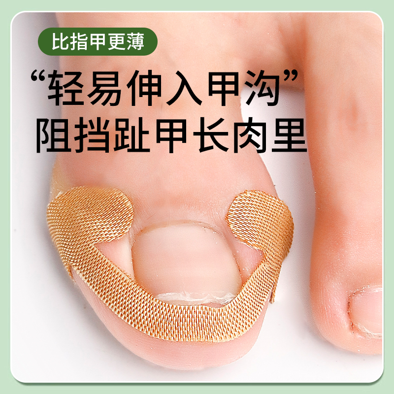 甲沟神器指甲矫正器隔离脚趾