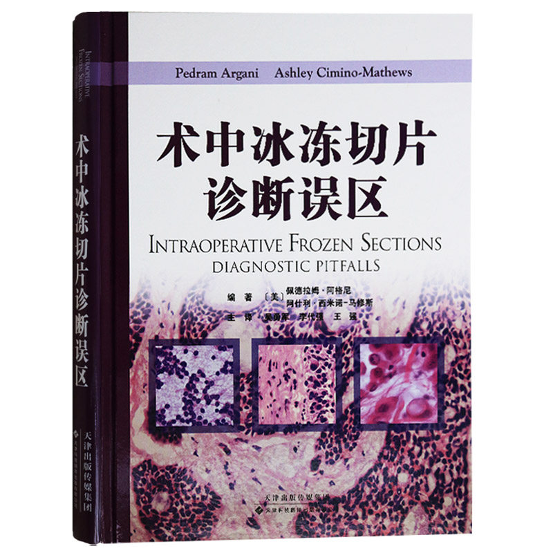 正版 术中冰冻切片诊断误区(国外引进)(中文翻译) 佩德拉姆阿格尼 阿什利西米诺-马修斯著 天津科技翻译出版公司