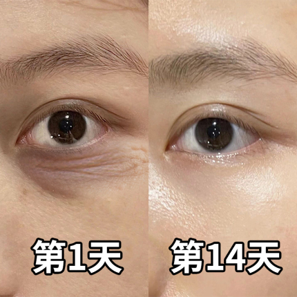 【小红书热推】再见眼角纹 淡化黑眼圈 收缩眼袋提拉眼部男女通用