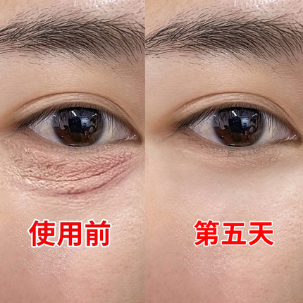 【小红书爆款】再见眼角纹 淡化黑眼圈 收缩眼袋提拉眼部男女通用