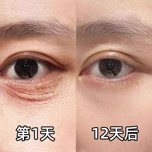 淡化细纹眼霜去眼黑眼圈提拉眼部