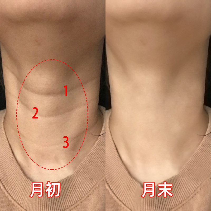 【12天去颈纹 还你天鹅颈】去颈纹霜美颈霜~别让颈纹暴露你的年龄