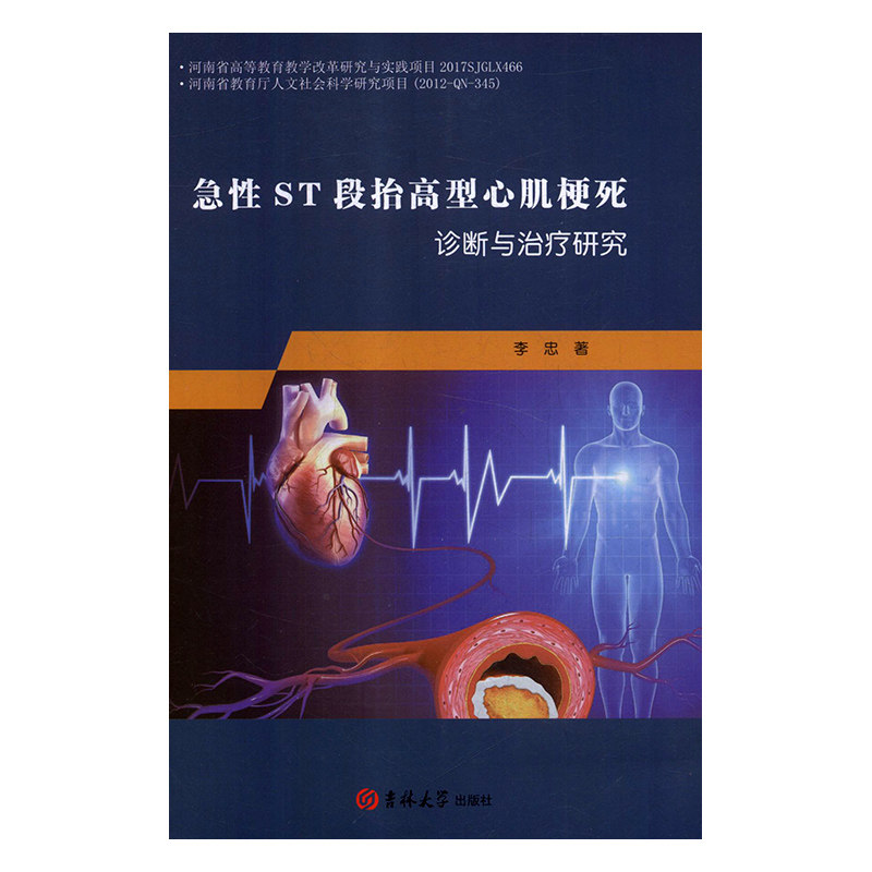 正版书籍急性ST段抬高型心肌梗死诊断与治疗研究 作者李忠的书 吉林大学出版社 9787569234084书号|msdalam kategori buku/Magazine/akhbar, Kesihatan perubatan, ubat lain - dari Buy2taobao.com untuk memberikan perkhidmatan ejen Taobao profesional membeli