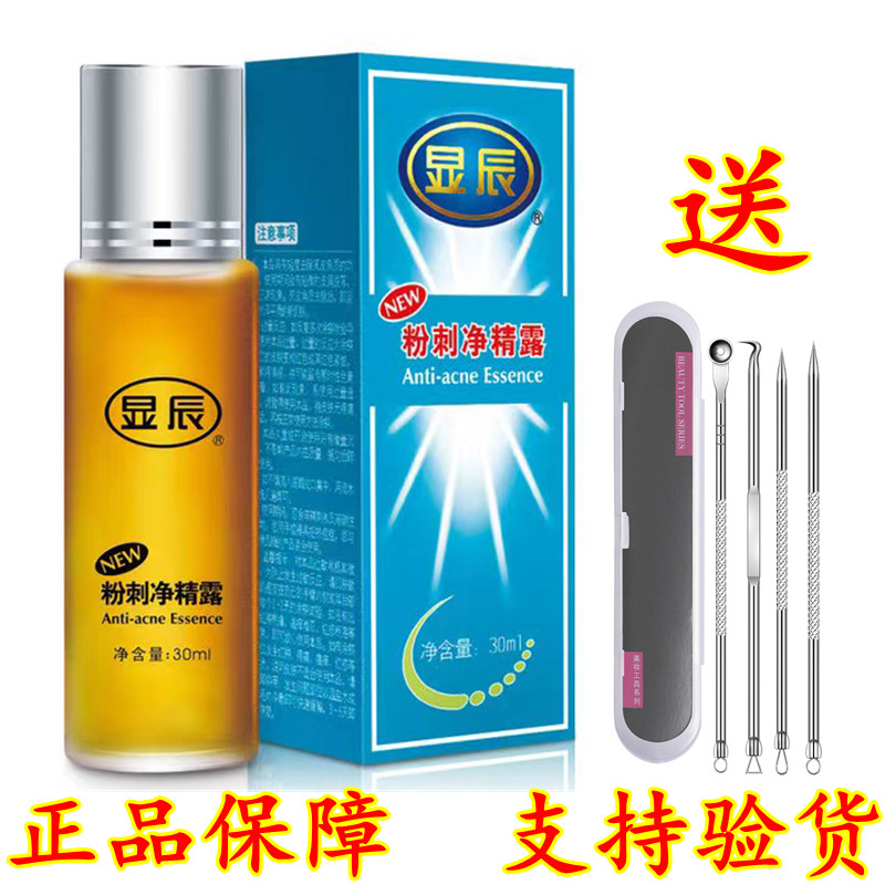 显辰粉刺净精露30ml大痘小痘肌适用泽平安徽上海华伊美老品牌