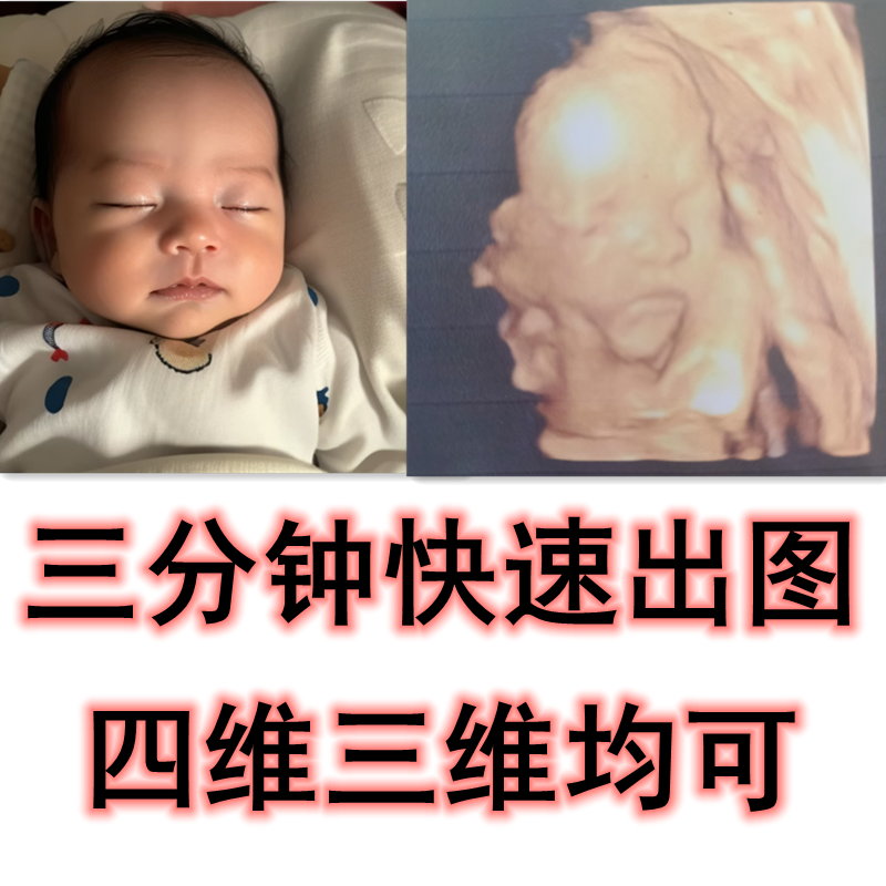 AI四三维彩超生成预测孕妈妈宝宝未来长相