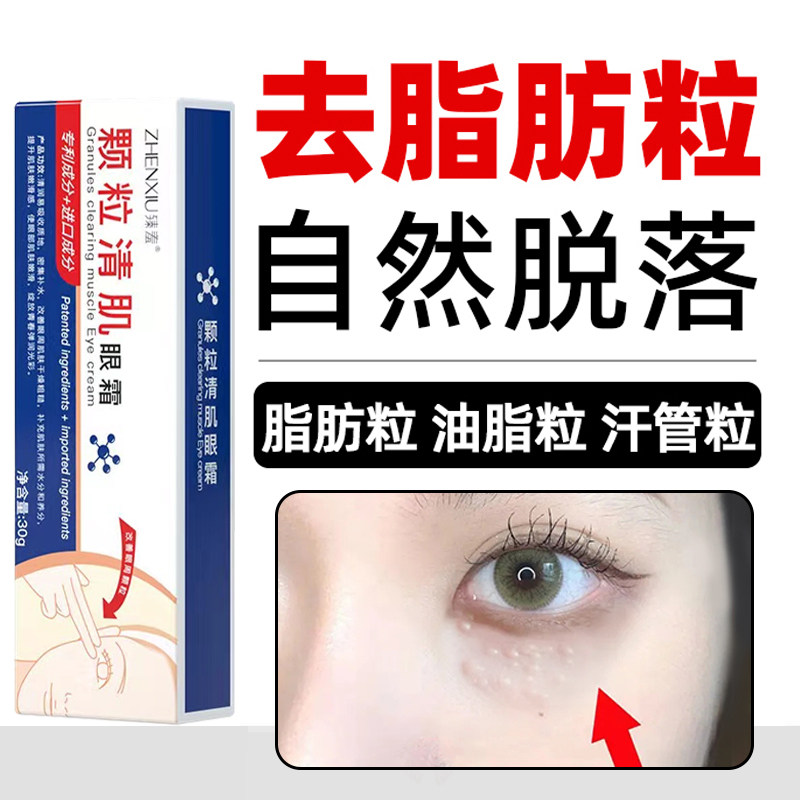 德国进口KG脂肪粒去除神器汗管粒眼部祛除油脂眼角颗粒清肌润霜