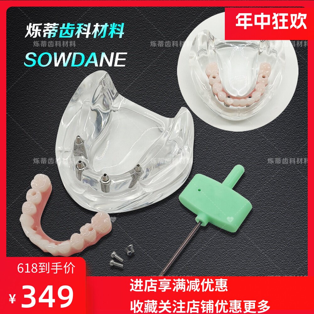 口腔模型马龙连桥义齿修复种植牙齿仿真演示模拟教学齿科医患交流