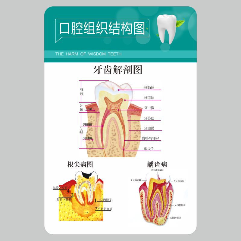 亚克力口腔组织结构图海报牙科挂图上墙定制做
