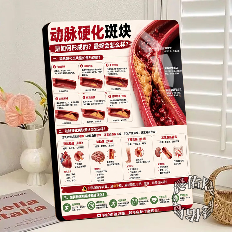 动脉硬化斑块阶段危害医院诊所桌面展示新款相框血管健康装饰摆台