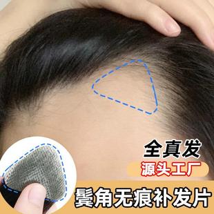 头部伤疤疤痕真发补发贴片无痕假发块生物头皮粘贴在头上的假发片