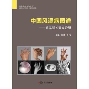 张奉春 社 肖飞 类风湿关节炎分册 中国风湿病图谱 现货中国风湿病图谱 复旦大学出版 正版