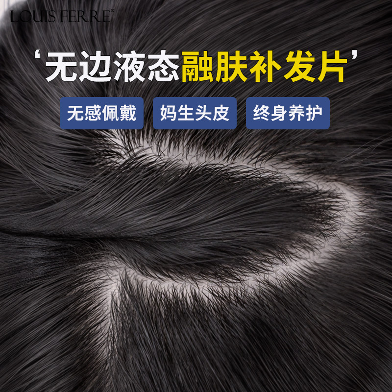 假发片女头顶双递针全真人发丝蓬松增发量遮白发刘海假发