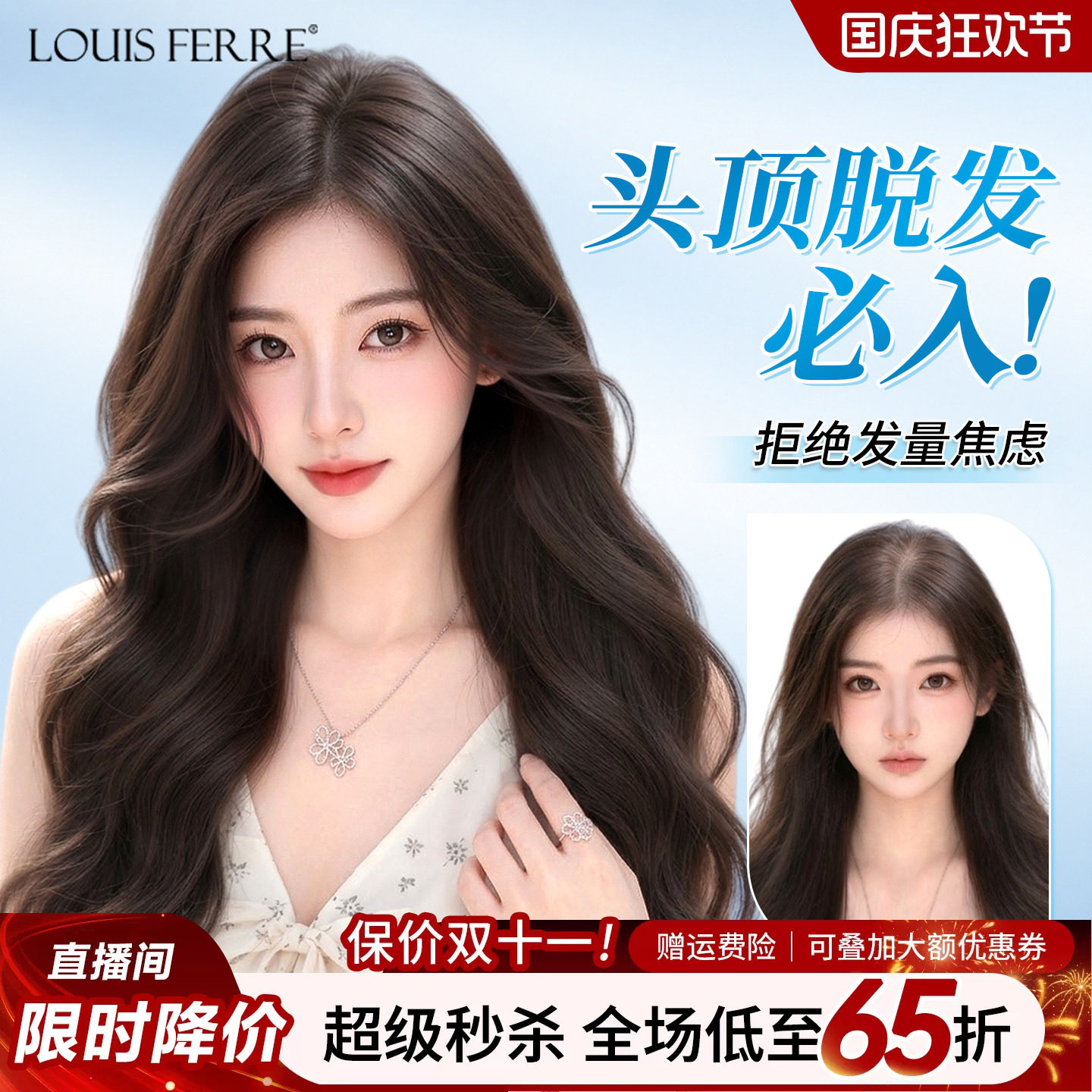头顶脱发必入免发网假发片女全真人发遮白发长卷发补发片蓬松无痕