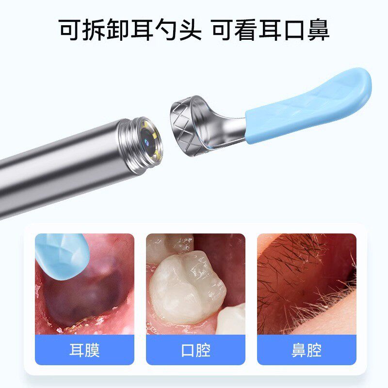 可视挖耳勺掏耳朵工具专业采耳套装带灯发光高清儿童耳勺专用神器
