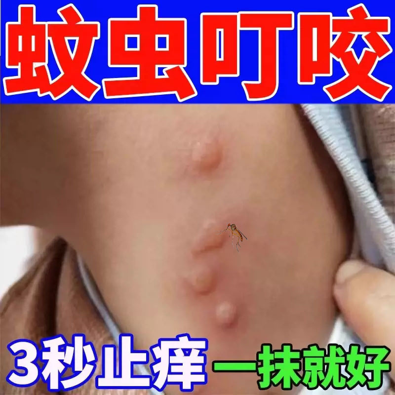 蚊虫叮咬快速止痒神器的药膏儿童宝宝专用被蚂蚁咬过敏瘙痒膏
