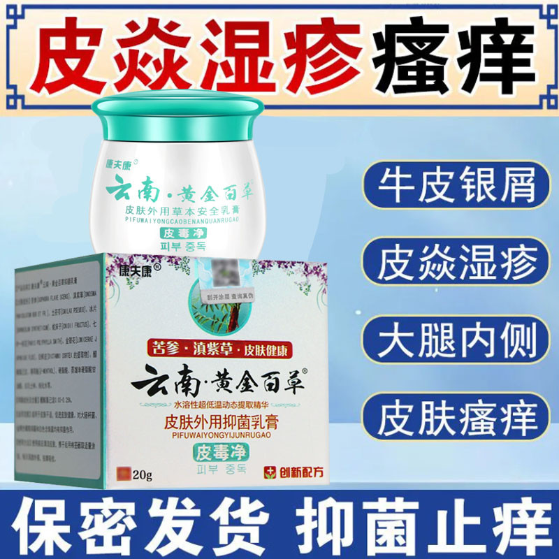 银屑癣牛皮癣克霉唑乳膏湿疹皮炎牛皮癣头皮癣体癣手足癣皮肤外用