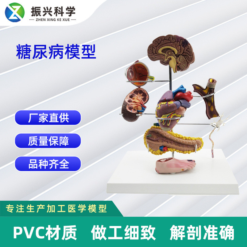 糖尿 病模型 教学模型教具工厂多规格可选