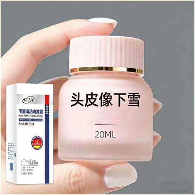【重度头屑】LYLX进口毛炎宁洗发水去屑止痒控油蓬松头皮清洁发露