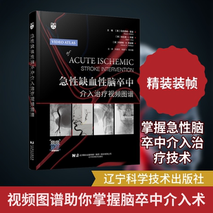 急性缺血性脑卒中介入治疗视频图谱