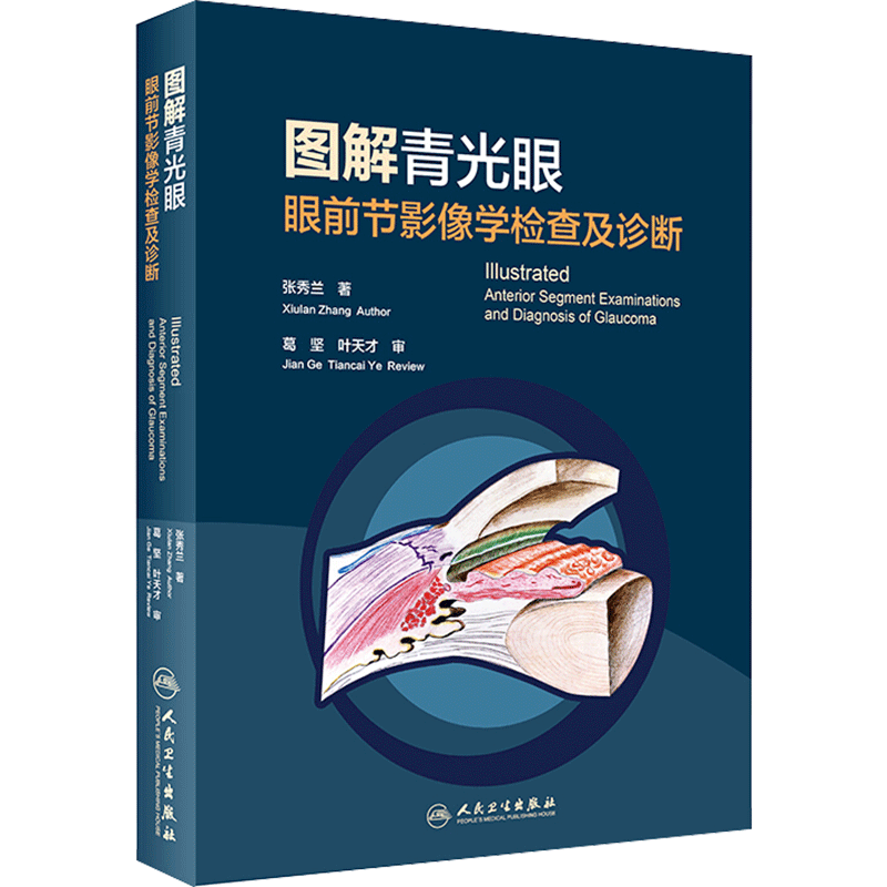 图解青光眼 眼前节影像学检查及诊断 张秀兰 著 眼科学生活 新华书店正版图书籍 人民卫生出版社