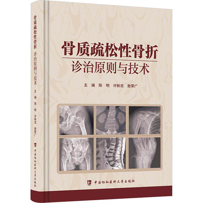 骨质疏松性骨折——诊治原则与技术 陈明,许新忠,敖荣广 主编 外科学生活 新华书店正版图书籍 中国协和医科大学出版社