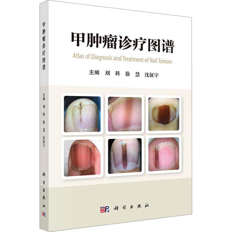 甲肿瘤诊疗图谱 刘科,徐慧,沈征宇 主编 皮肤病学/性病学生活 新华书店正版图书籍 科学出版社
