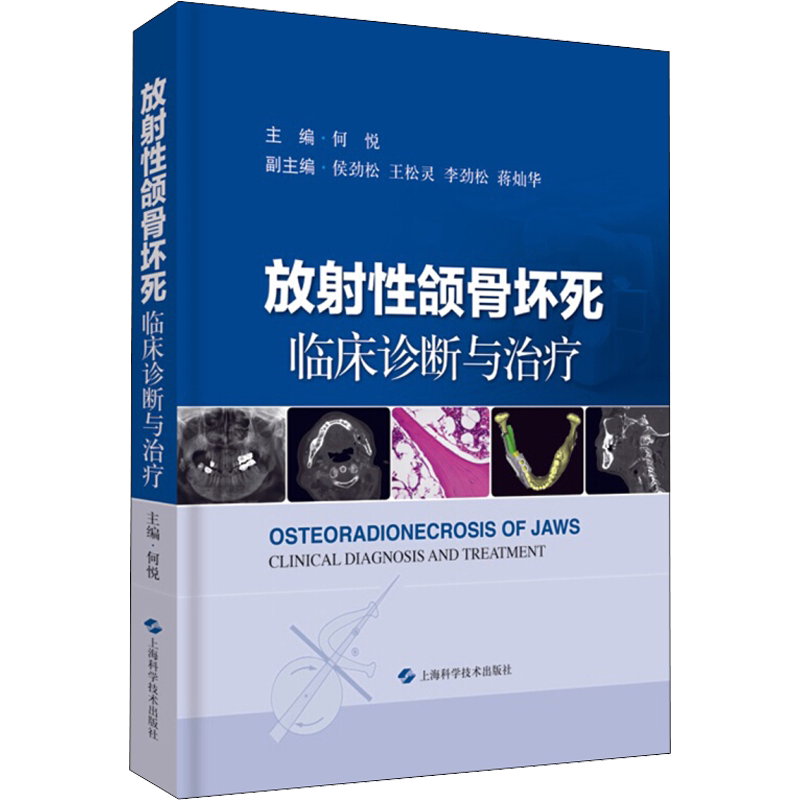 放射性颌骨坏死 临床诊断与治疗 何悦 编 临床医学生活 新华书店正版图书籍 上海科学技术出版社
