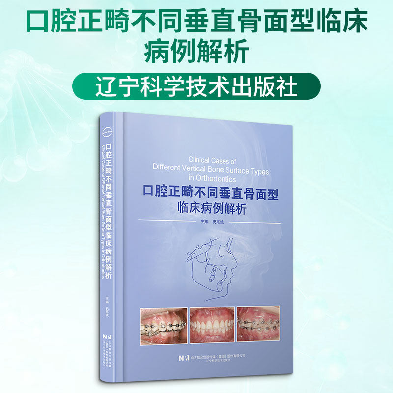 口腔正畸不同垂直骨面型临床病例解析 祝东波 主编 编 临床医学生活 新华书店正版图书籍 辽宁科学技术出版社