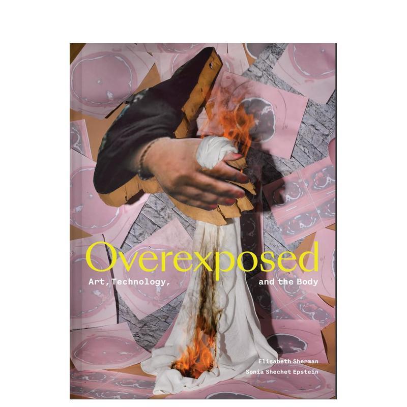 【预售】过度曝光：艺术、技术与身体 医学影像技术作品集 Overexposed: Art， Technology， and the Body 英文进口原版艺术画册