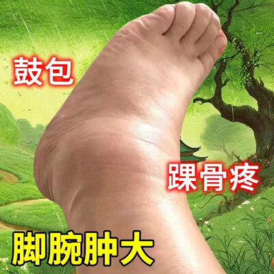 脚踝肿大疼痛专用药骨裂陈旧老伤关节肿大活血化瘀韧带拉伤药水
