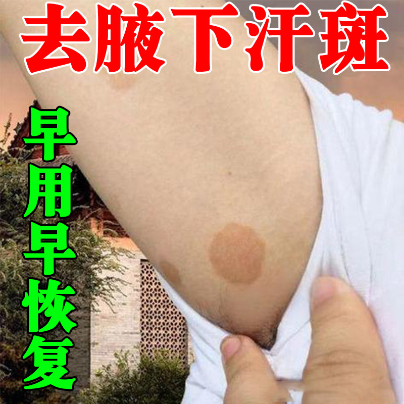 汗斑净去汗斑专用去胸前后背腋下白斑花斑褐色斑止痒膏杀菌专用膏