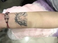 美国疤痕遮瑕包邮套装
