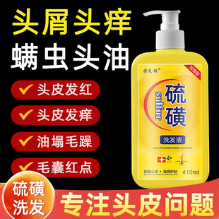 硫磺洗发水去屑头皮毛囊头痒除螨控油10%洗头膏沐浴露液体皂