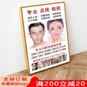 男女面痣图祛斑痘古方祛痣疤痕宣传脸部风水图美容院墙壁装 饰挂画