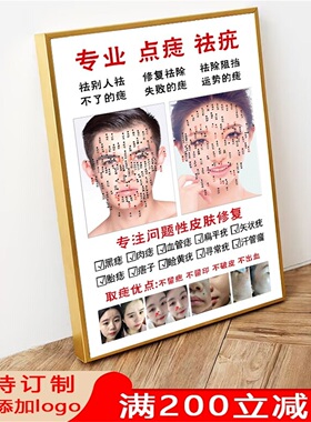 男女面痣图祛斑痘古方祛痣疤痕宣传脸部风水图美容院墙壁装饰挂画